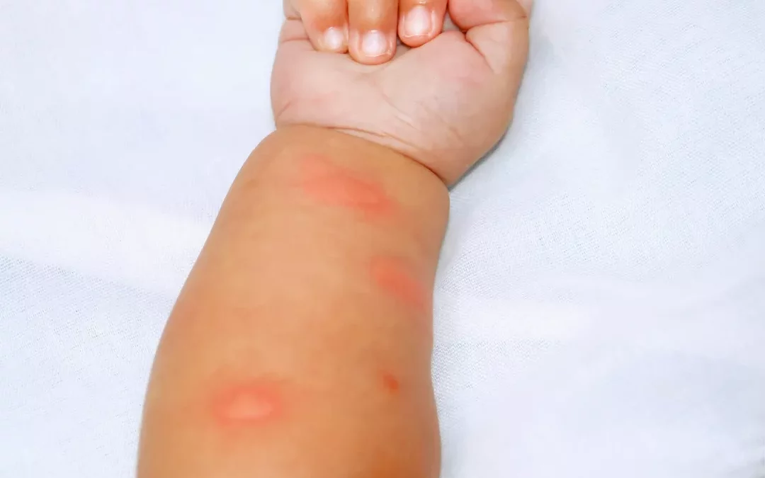 protéger votre bébé des punaises de lit